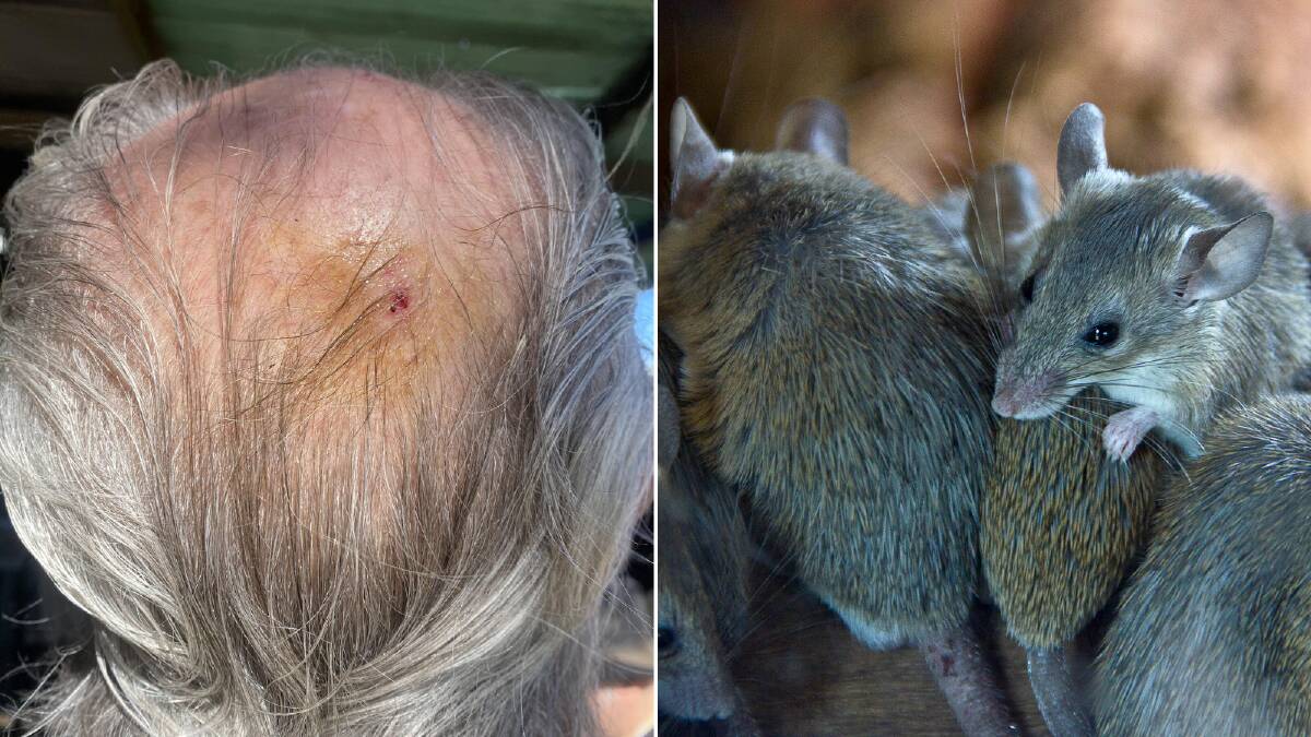 Man bitten on the head as he slept: Mouse plague pushing people to the brink